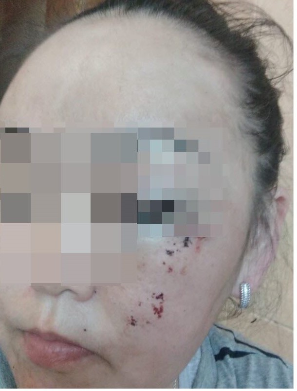 "Мне было больно и страшно": В Якутии женщина заявила о том, что ее избили и изнасиловали